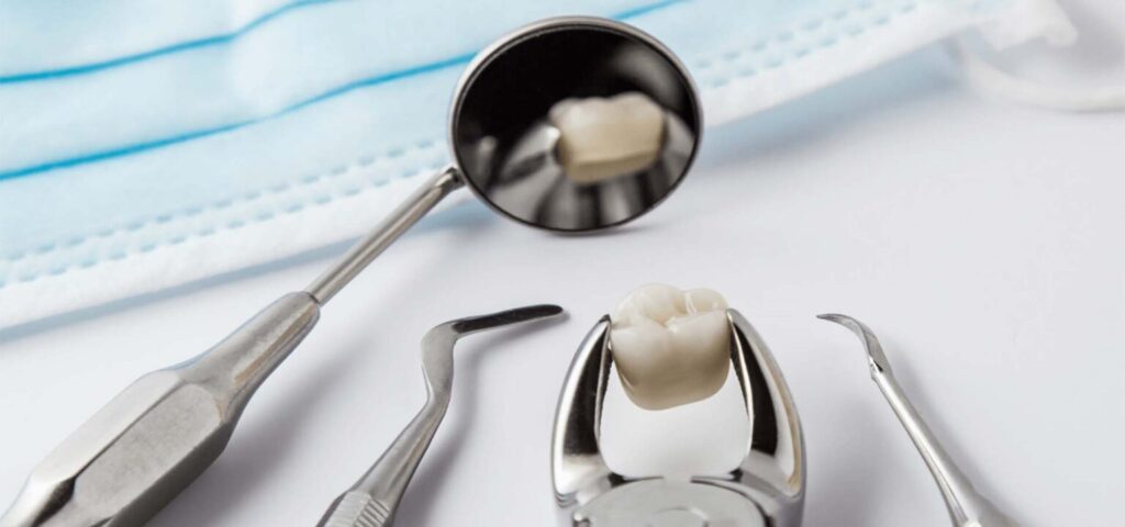 Estrazione del dente