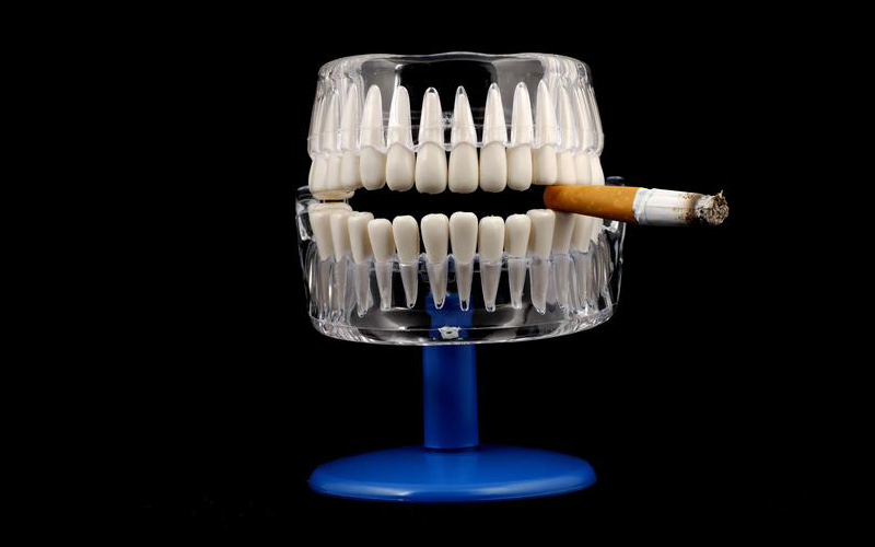Fumo e salute dei denti